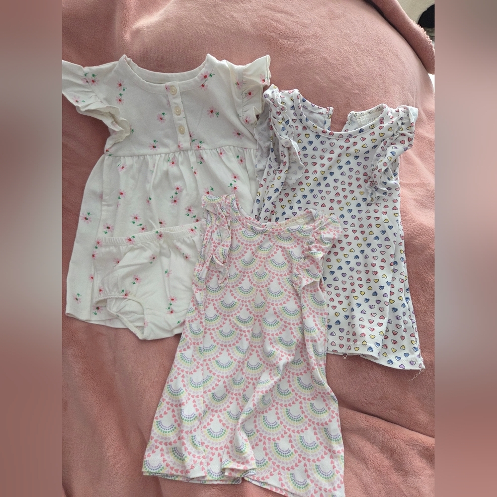 Adorable Baby Girl Dresses Set